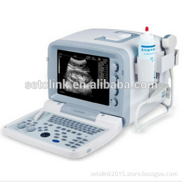 Laptop ultrasound scanner